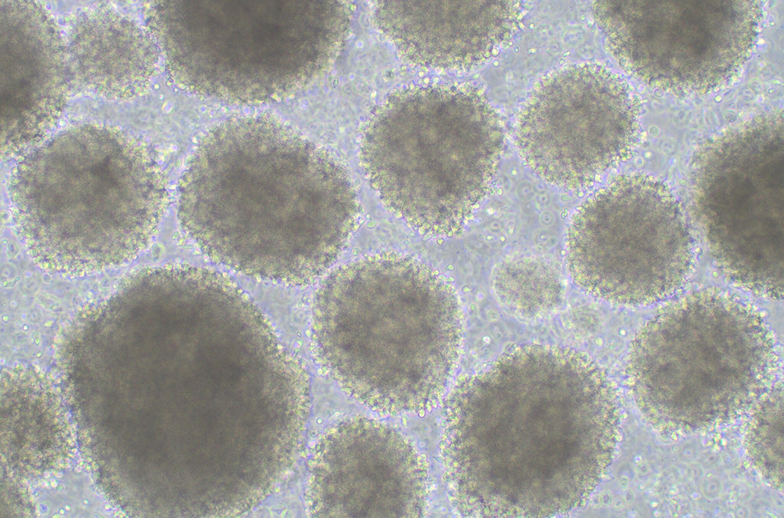 Standardized Cryopreservation Protocol and Quality Control for Biobanking of Natural Killer (NK) Cells